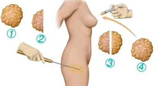 胸可以夹阴痉吗？专家解答：这种行为可能带来的危害你知道吗？