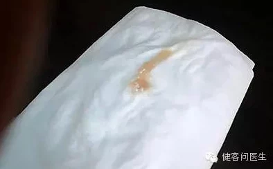 胡桃尿道口流出白色脓状物是什么？用户评论称可能是感染，建议及时就医！