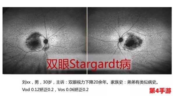 超级胬肉系统第二部叫什么？一触即发，久久难忘
