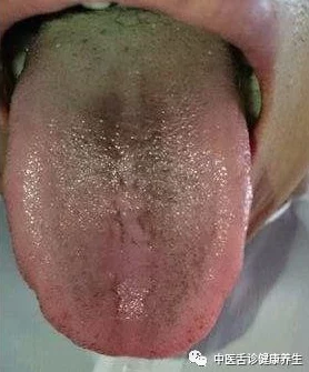 舌头探洞水好多，科学家发现新型生物适应极端环境的惊人能力